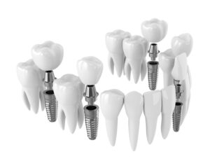 AGUILARS Clínica Odontológica — foto