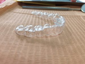 Atracción Dental | Clínica Dental en Lima & Urgencias & Implantes & Alineadores Invisibles & Blanqueamiento & Brackets — foto