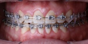 Centro Dental Prevenir — foto