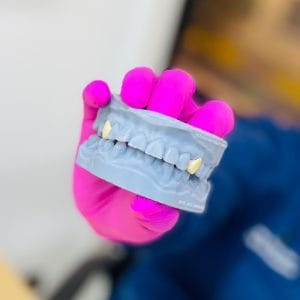 Clínica Dental Cano – Dentista en Miraflores | Alineadores Invisibles — foto