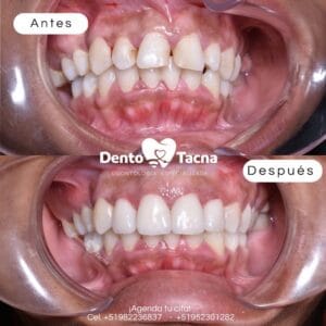 Clínica Dental Dento Tacna | Implantes dentales Tacna — foto