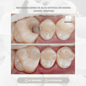 Clínica Dental Dento Tacna | Implantes dentales Tacna — foto