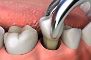 Clínica Dental Pardo EIRL — foto