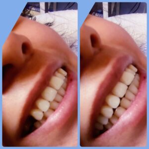 Consultorio dental Dentalia — foto