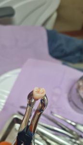Consultorio Dental – Dra. Estefania Chacón Fernández Dávila — foto