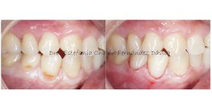 Consultorio Dental – Dra. Estefania Chacón Fernández Dávila — foto