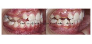 Consultorio Dental – Dra. Estefania Chacón Fernández Dávila — foto