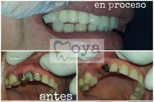Consultorio Odontológico MOYA — foto