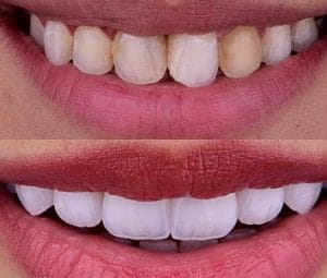 DENTOPLUS Piura Clínica dental — foto