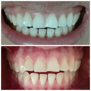 DentSalud Consultorio Odontologico — foto