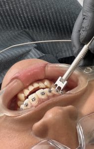 DENTUM – Clínica Dental, Brackets, Ortodoncia, Odontólogos, INVISALIGN, Dentistas, Curaciones Dentales en Niños, Jesús María — foto