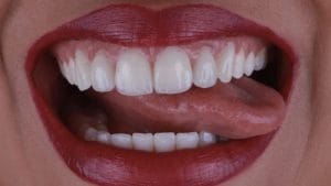 EVOLUTION-Clínica Dental Trucios — foto