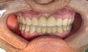 fabricando sonrisas – dentista en Surco — foto