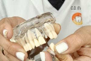 Impacto Dental Jesús María | Diseño de Sonrisa | Ortodoncia | Implantes | Alineadores — foto