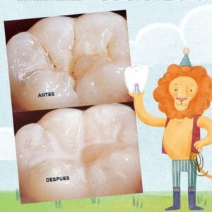 Mi León Dentista — foto