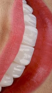 OBI 3D – ODONTOLOGIA BIOMIMETICA 3D — foto