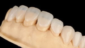 OBI 3D – ODONTOLOGIA BIOMIMETICA 3D — foto