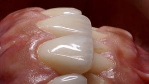 OBI 3D – ODONTOLOGIA BIOMIMETICA 3D — foto