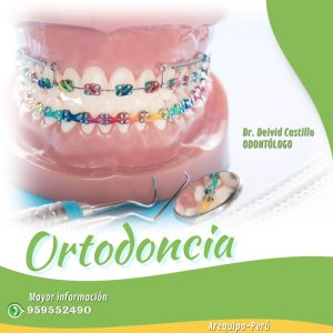 Ortodoncia brackets | BIODENS AQP | Clinica dental