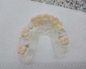 Visident — foto